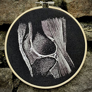 Anatomy of  an MRI scan of the knee.  A cross section in embroidery by Cath Janes