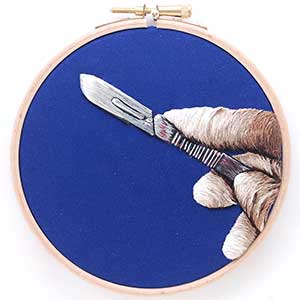 A Sharp Scratch is an embroidered hoop of a surgeon's scalpel and latex glove by Cath Janes 