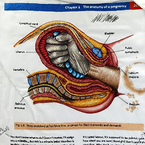  Hand embroidered anatomical art - Torment and Demands by Cath Janes